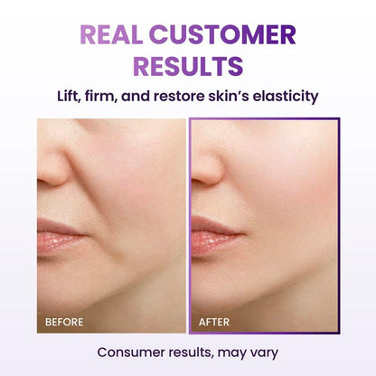 Soliana™ LumiLift Cream